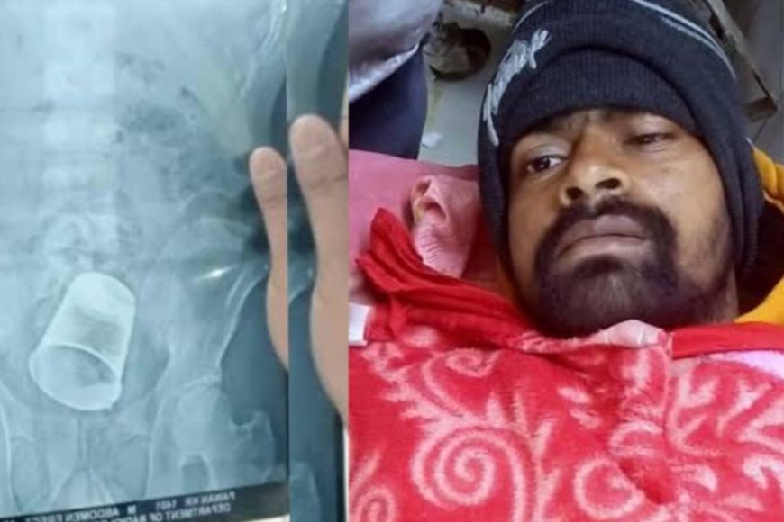 Bihar News: ससुराल वालों ने दामाद के साथ की मारपीट, प्राइवेट पार्ट में डाला स्टील का ग्लास